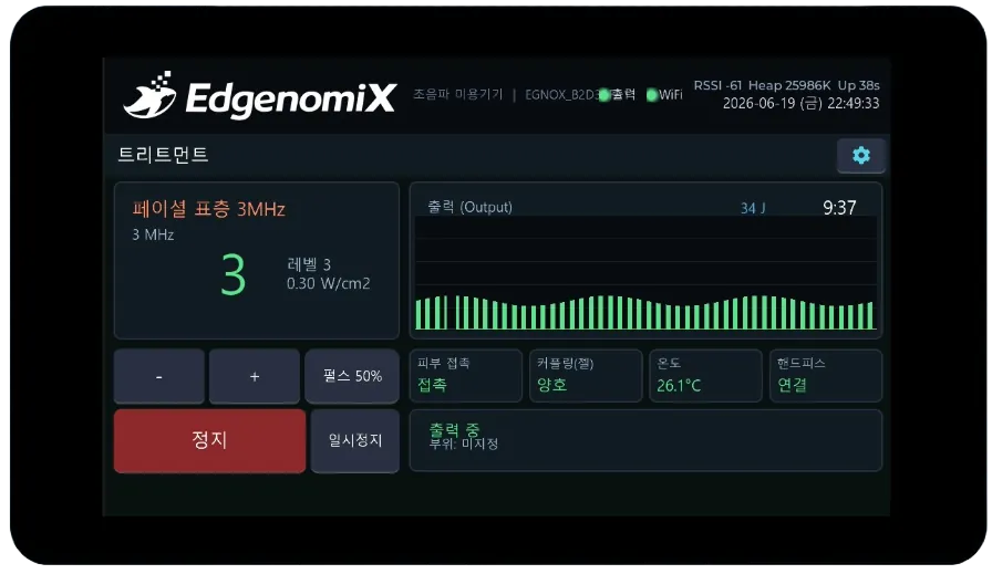 초음파 미용기기 HMI — 페이셜 표층 주파수, 출력 레벨, 펄스, 피부 접촉·커플링 상태