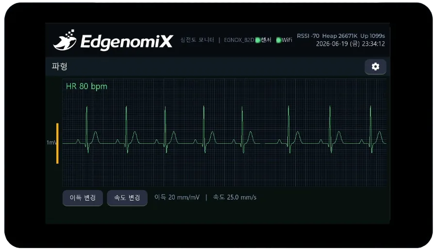 심전도 모니터링 HMI — 실시간 ECG 파형, 심박수, 이득·속도 설정