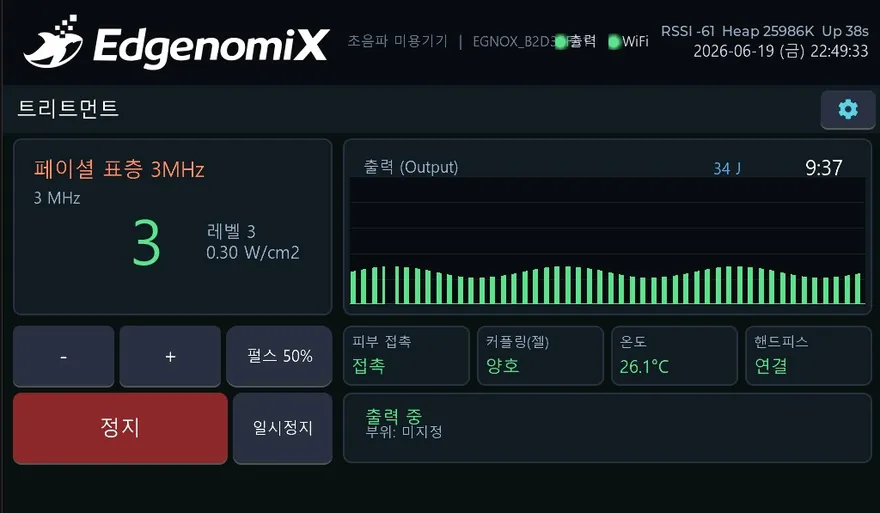 초음파 미용기기 제어 HMI — 메인 화면