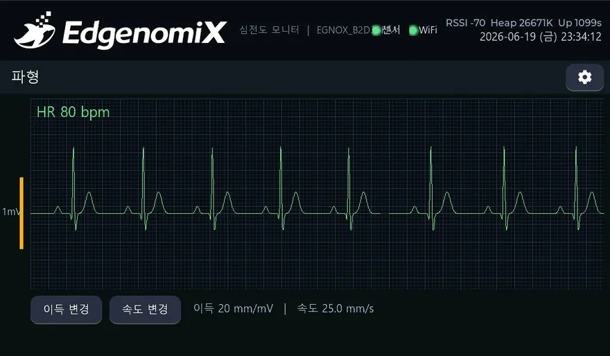 무선 심전도 모니터 (레퍼런스 데모) — 실시간 파형 화면