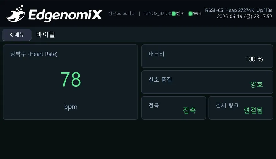 무선 심전도 모니터 (레퍼런스 데모) — 바이탈 화면